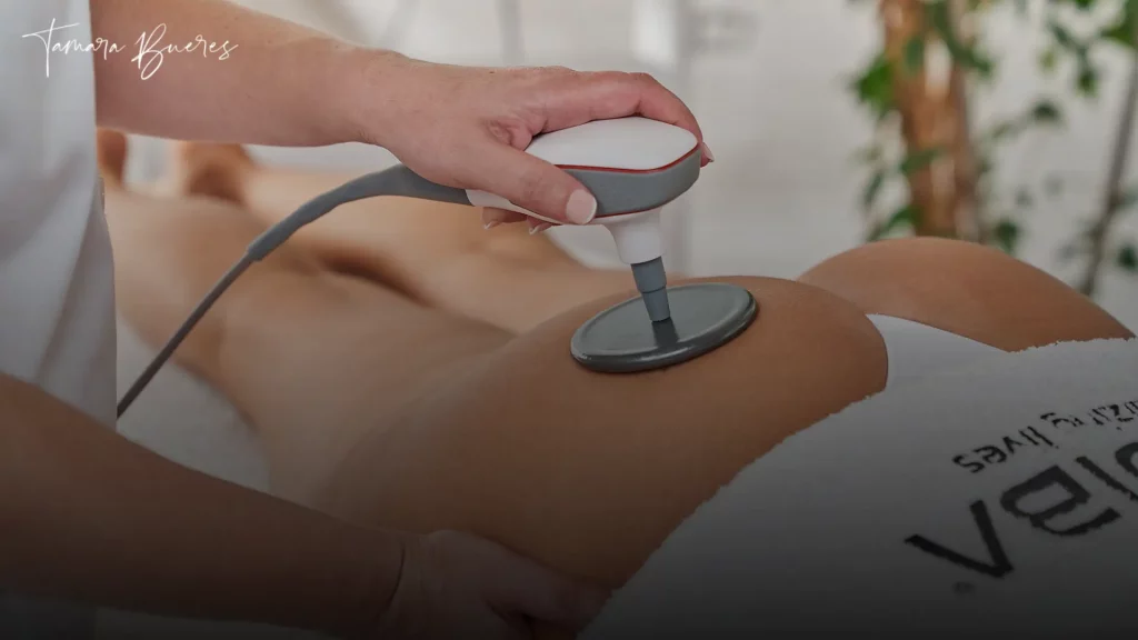 tratamiento anticelulítico con radiofrecuencia indiba