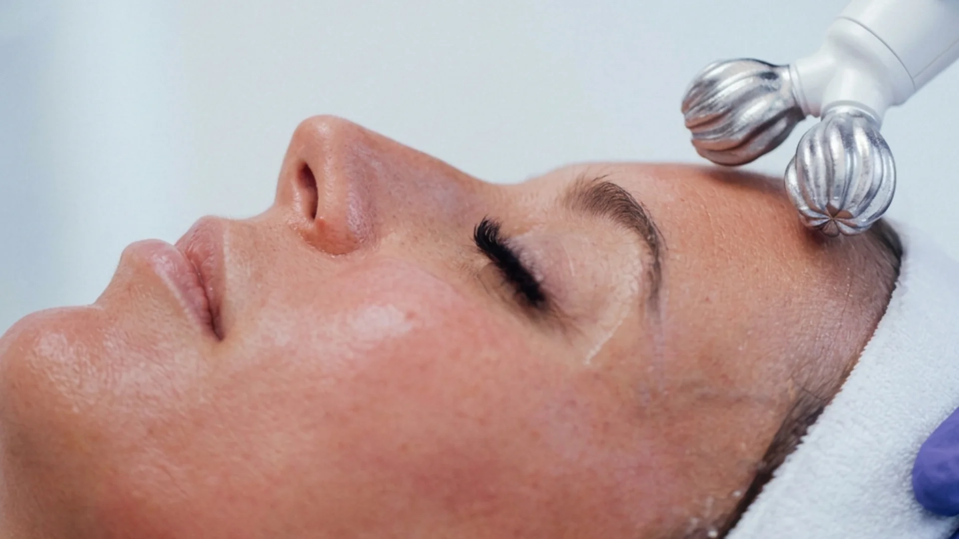 Cabezal Workout de INDIBA ONA tonificando el músculo facial y redefiniendo el óvalo en Centro de Estética Tamara, Llanes